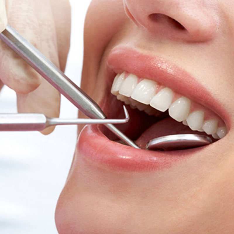 Image hover effect image